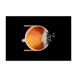 Volk Pan Retinal 2.2 clear