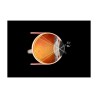 Volk Pan Retinal 2.2 clear