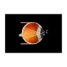 Volk Macula PLus 5.5